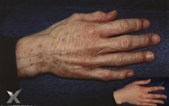 Maggie_hand-silicone aged