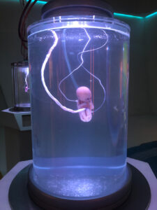fetus rental prop